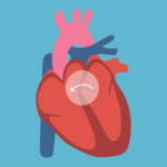 What are congenital heart defects?