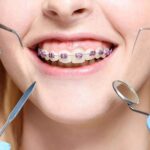 Dealing With Orthodontic Emergencies: What To Do