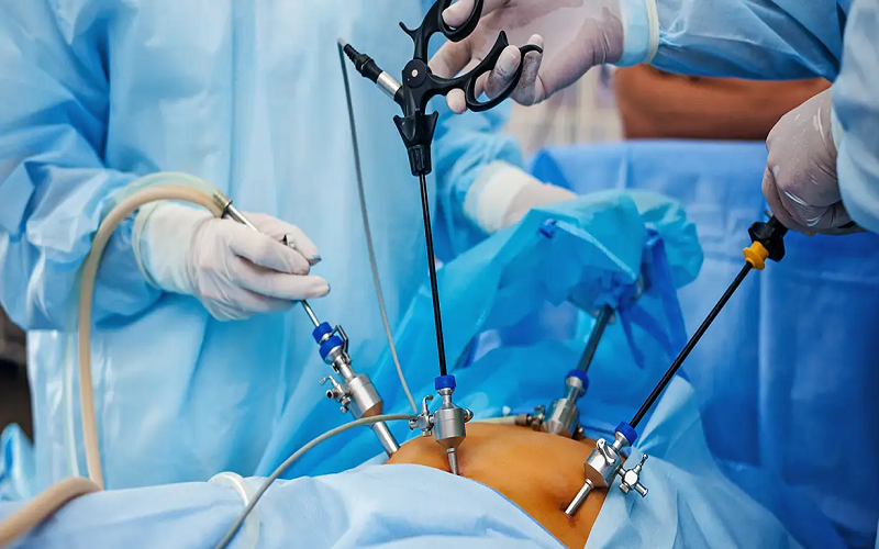 Laparoscopic Surgery